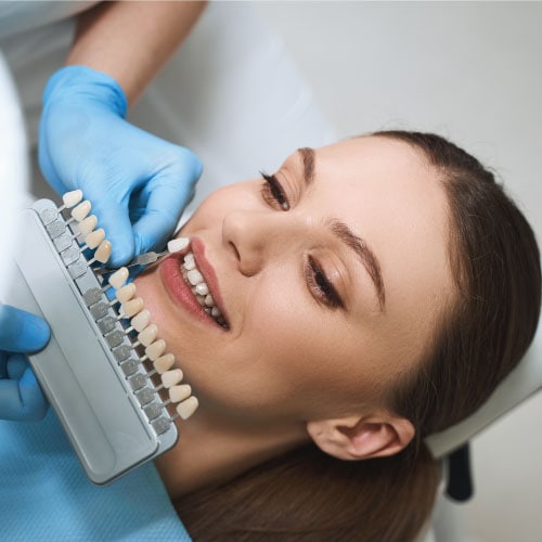 canyon road dental provo ut services veeners image canyon road dental provo ut services veeners image