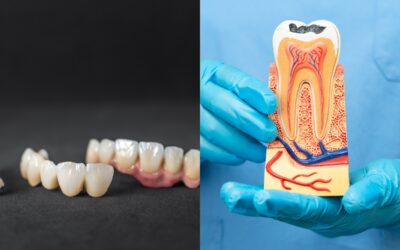 Can You Get a Root Canal and Crown on the Same Day?