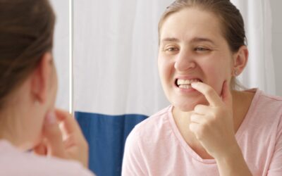 How Do Dentists Handle Severe Tooth Infections?