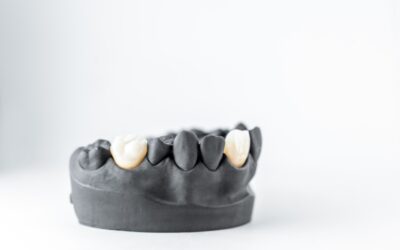 How Does A Dentist Remove A Dental Crown?
