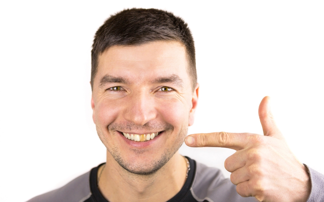 Tooth Turning Black But No Pain? Discover the Reasons