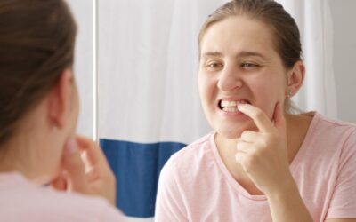 Home Remedies for Gum Recession: Myth vs. Reality